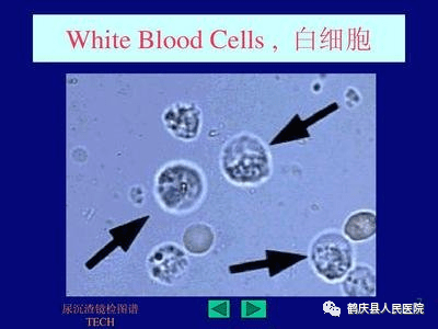 尿沉渣报告单图片