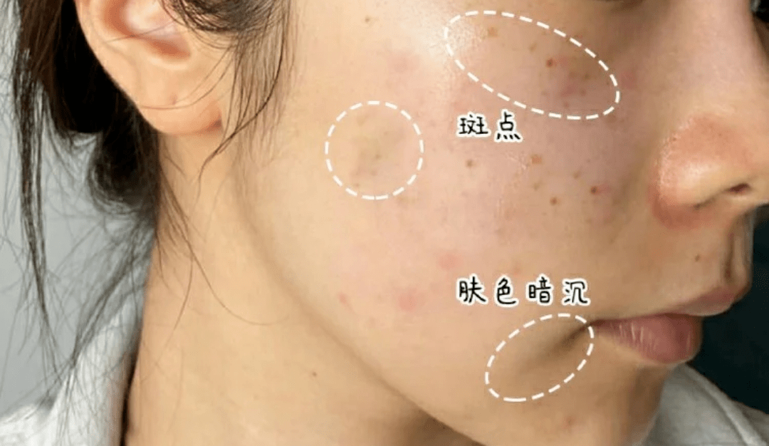 曾为年后5个显瘦小技巧，赶紧学