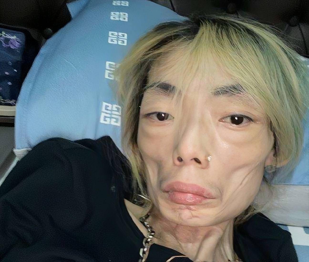 厌食症开始有所好转,太子爷前夫已经再婚_伍智恒_杨爱瑾_婚姻