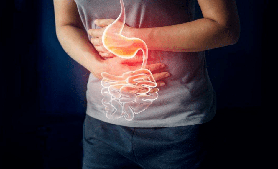 过完年肠胃不适胃胀胃痛胃反酸可能是黏膜损伤了