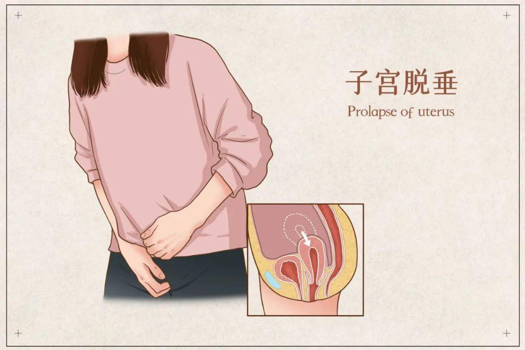 女性宫颈萎缩的图片图片