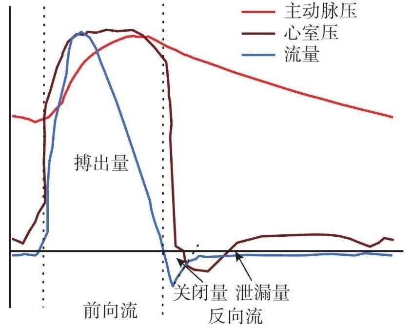 学术结构性心脏病时代医工结合人工心脏瓣膜体外血流动力学性能测试