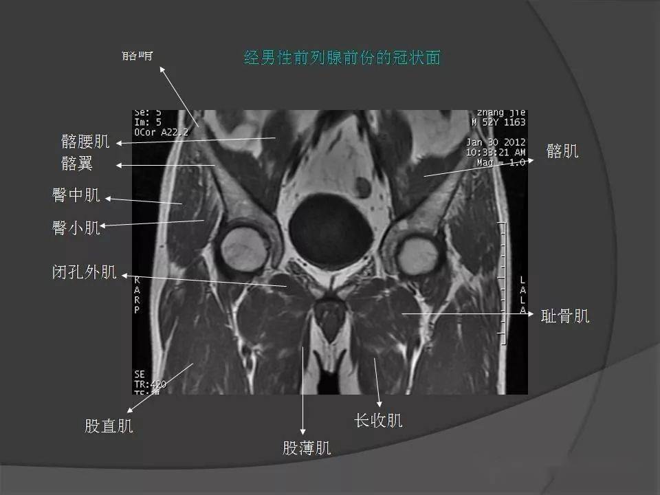 骨盆ct平扫图片解剖图图片