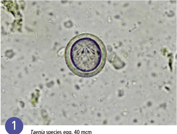 一文详解6种粪便检查技术_虫卵_寄生虫_溶液
