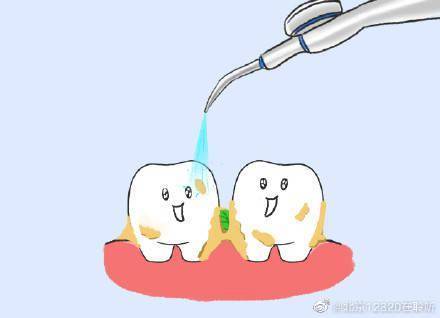 牙垢|洗牙会导致牙龈萎缩吗？