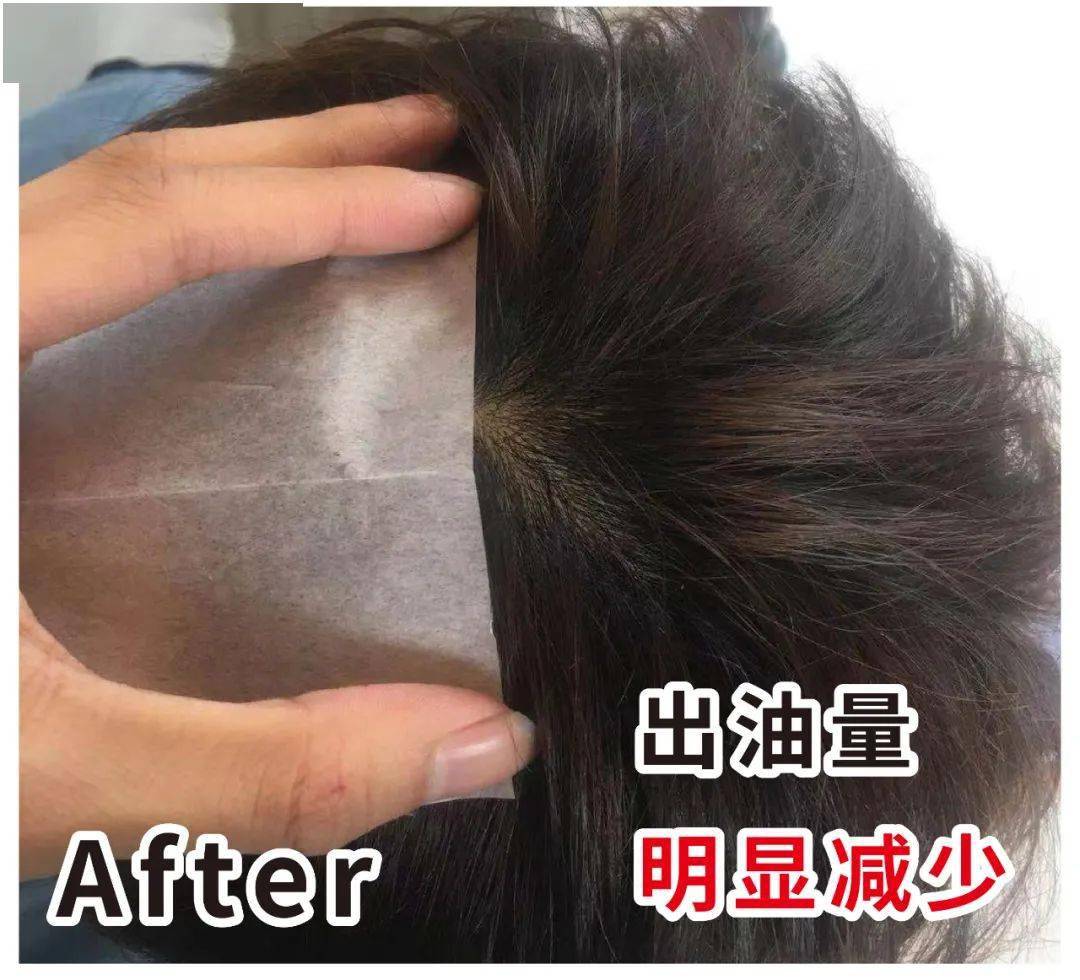 因为散着头发睡觉更健康？99%的女生都做错了，难怪头发油腻还脱发！