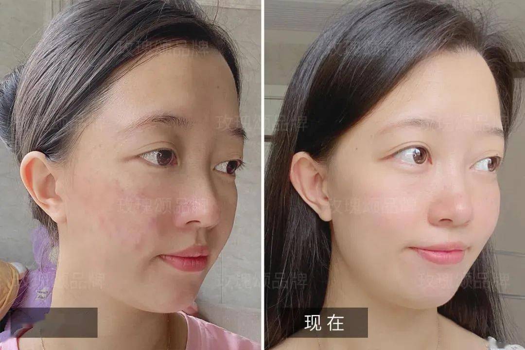 护肤品早晨不要着急洗脸，涂点精华，这样六十岁都肌肤如水！