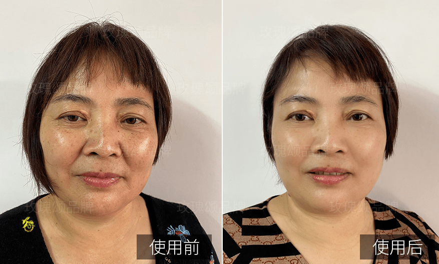 护肤品早晨不要着急洗脸，涂点精华，这样六十岁都肌肤如水！