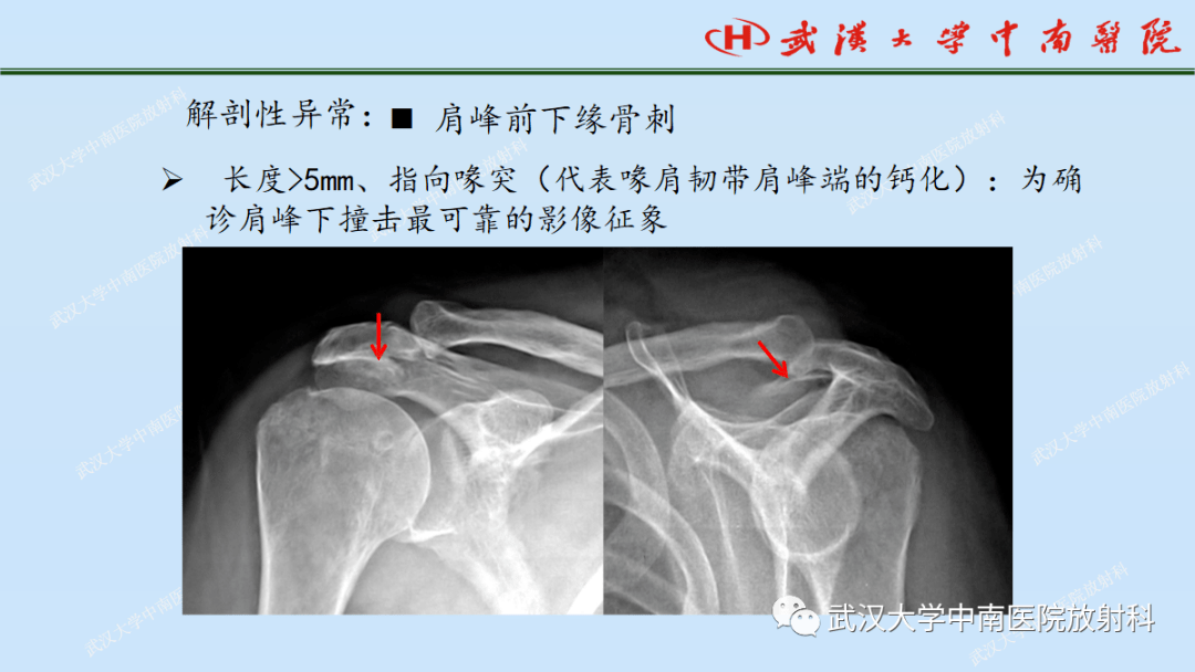 肩关节x线解剖图片