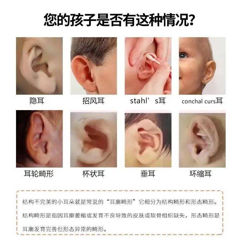 小耳朵是怎么形成的图片