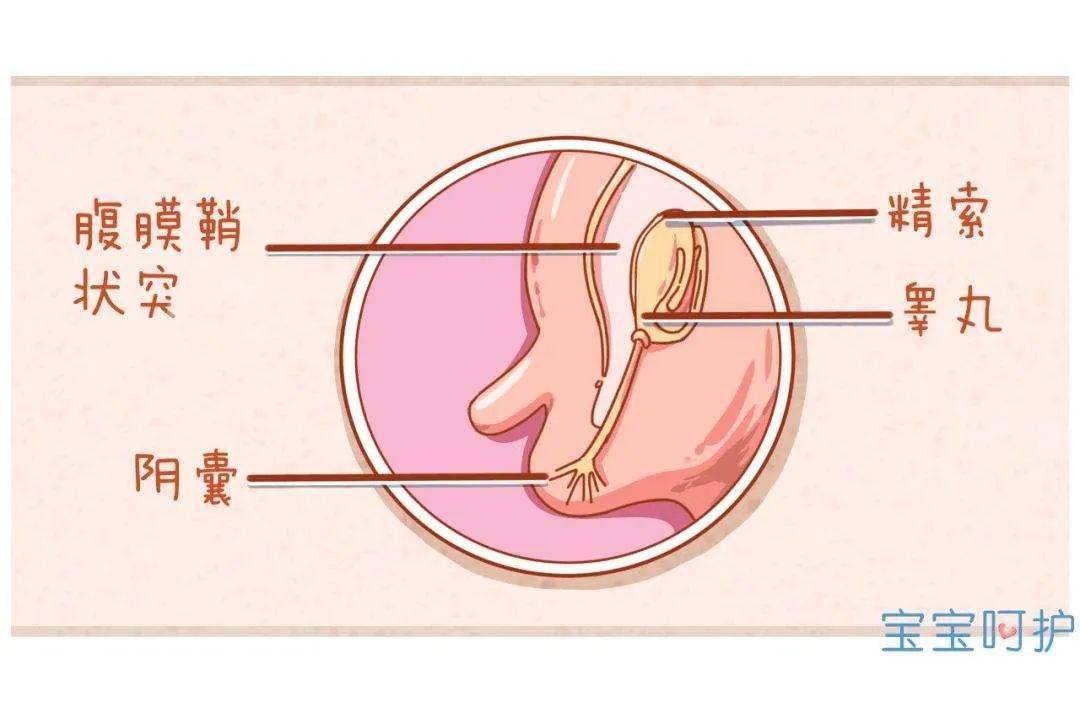 技术】治疗小儿疝气,我院这个微创技术轻松解决_手术_腹腔镜_腹股沟