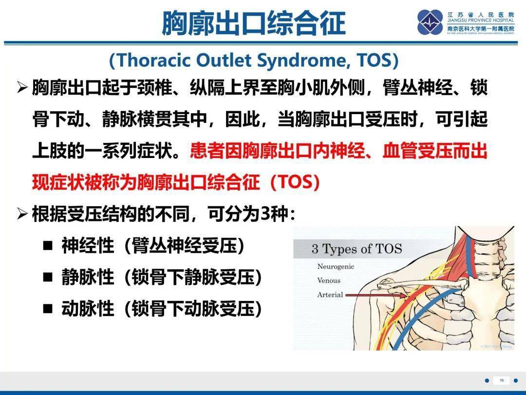 胸阔出口图片