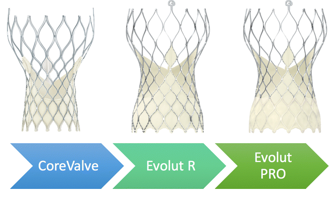 14次被微创起诉无产品商业化这一械企再闯港交所