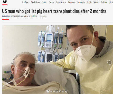 全球首例接受猪心脏移植患者死亡