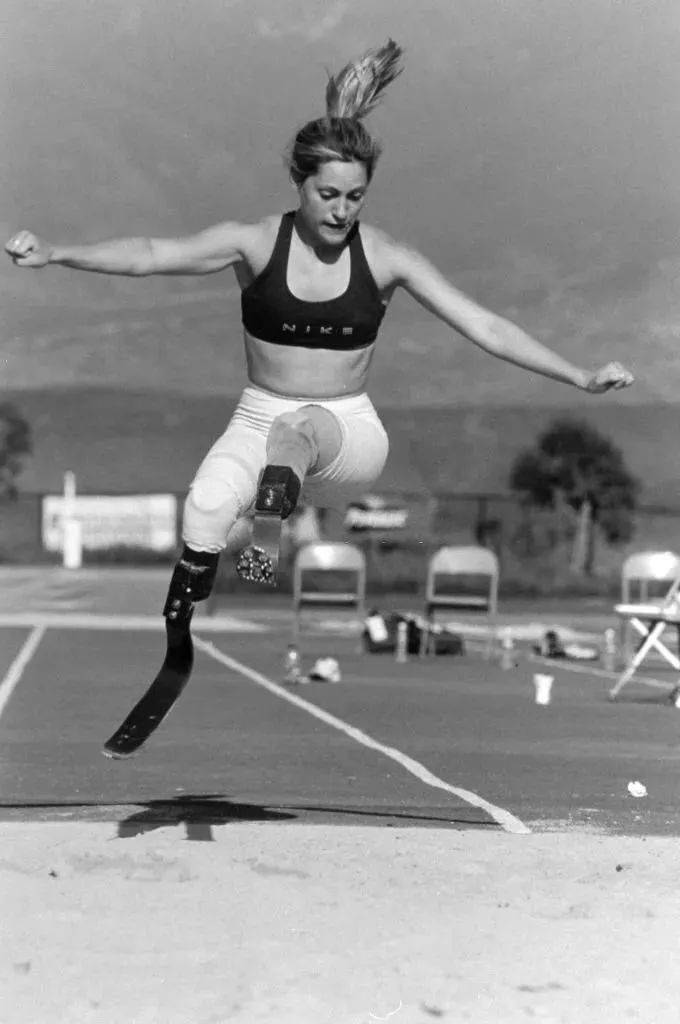 全球身高1米4,却被封“全球最美双腿”,网友:她美哭我了