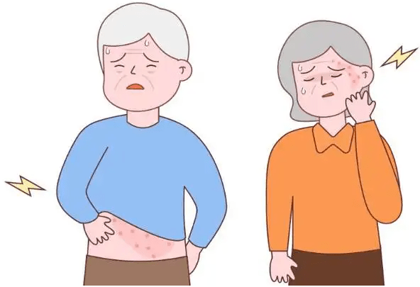 小熊医院可预约接种带状疱疹疫苗了_成人_水痘_疾病