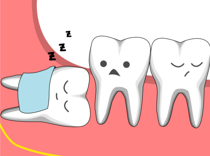 健康知多少丨拔智齿有个最佳时期别等疼了才想起来拔