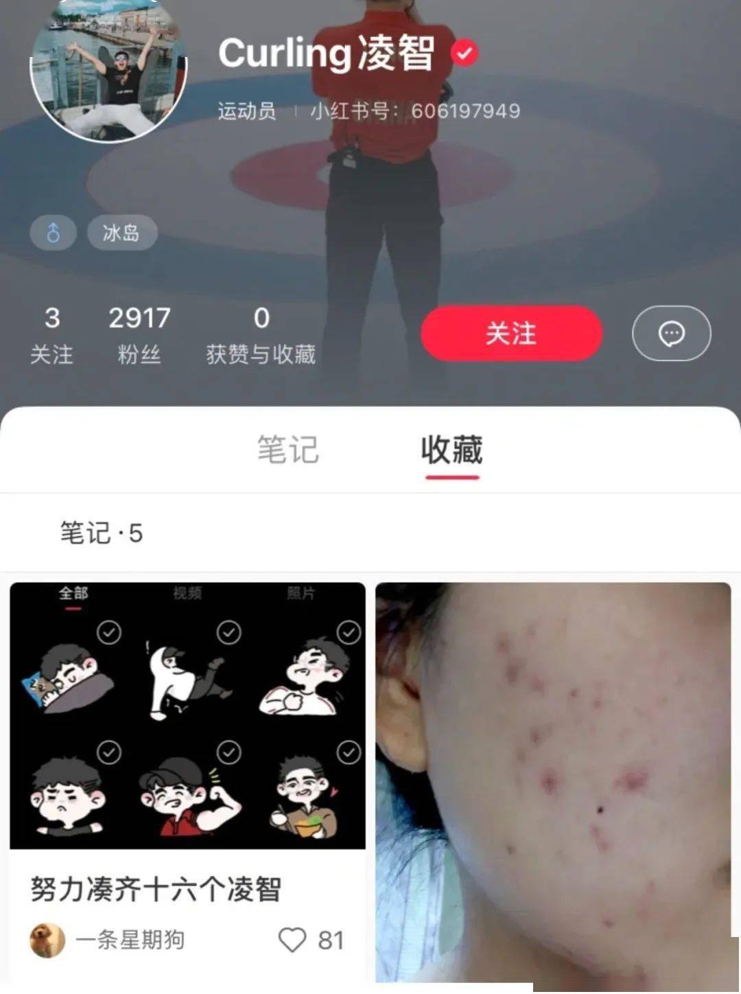 症状冰壶选手凌智的收藏夹里全是痘，怎么救？