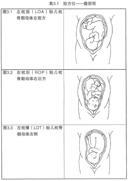 胎方位是以胎头枕骨(胎头的后部)与母体骨盆的前,后,左或者右的关系来