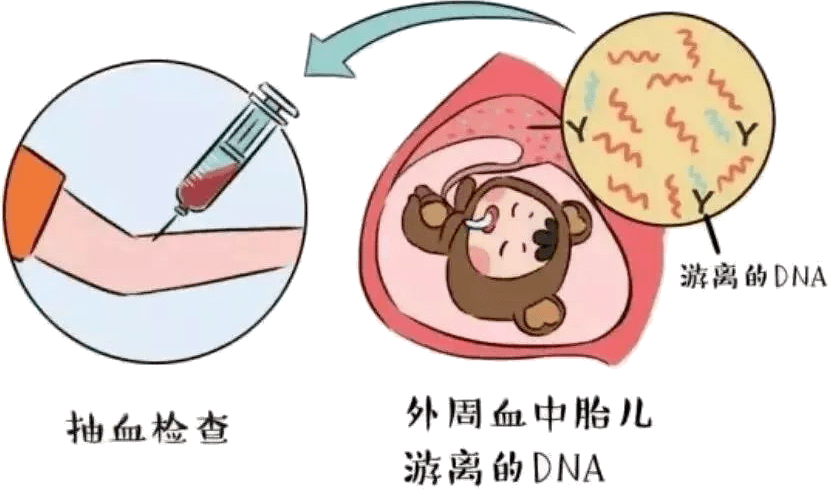检测母体血清中甲胎蛋白和游离绒毛膜促性腺激素(free-βhcg)等的浓度
