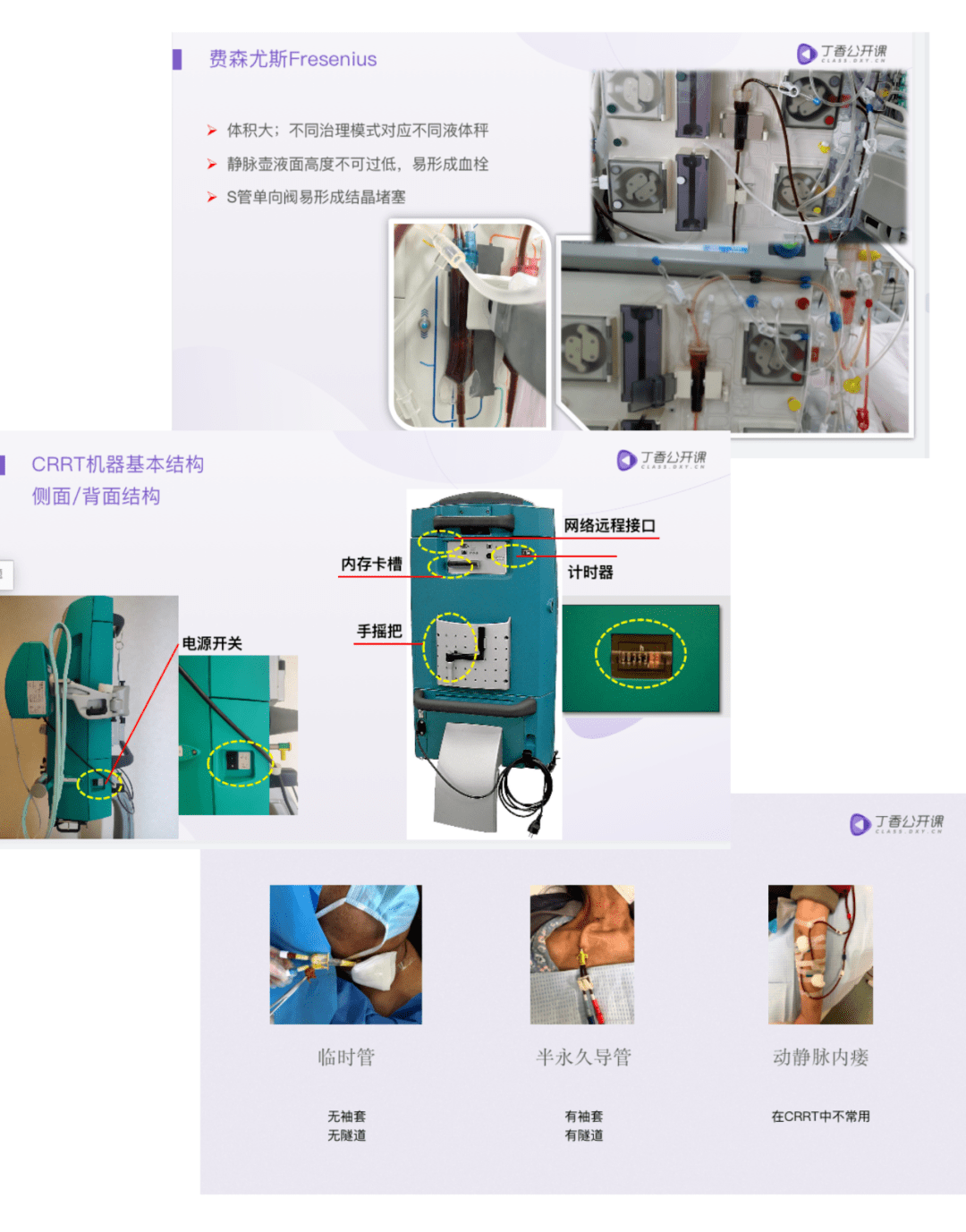 关于crrt你需要掌握的必备基础与抗凝要点都在这里