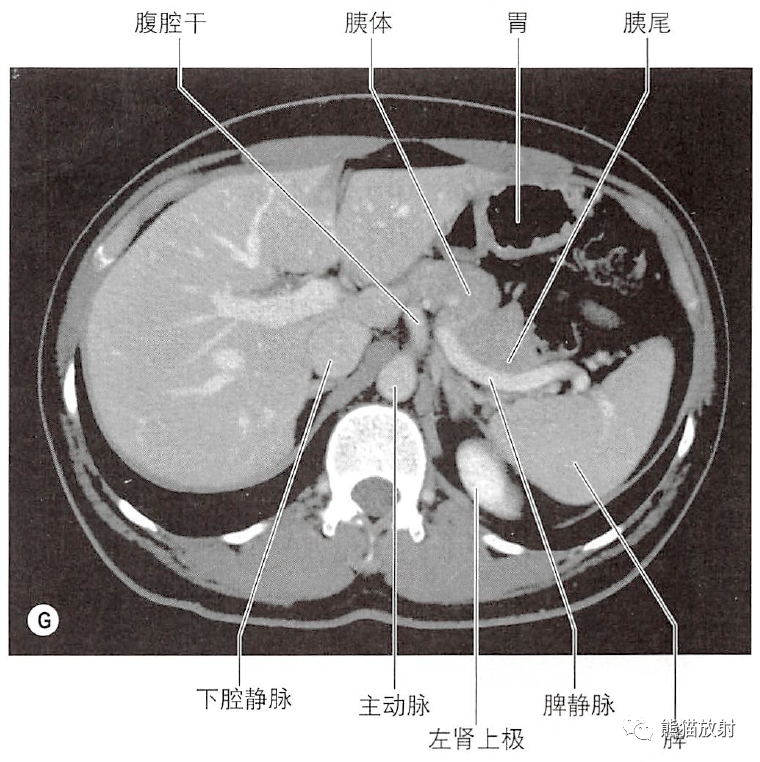 胆道系统ct解剖图图片