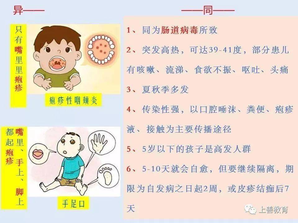 溫馨提醒:手足口 , 皰疹性咽峽炎高發期, 防治來了!_患兒_症狀_家長