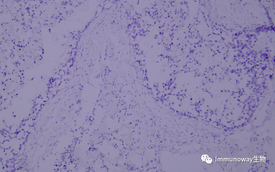 常见问题:3 标本的切片,捞片,烤片3 浸蜡应选择低熔点的石蜡,浸蜡应