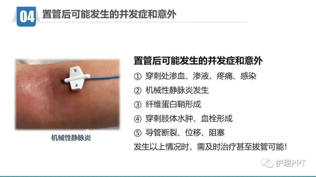 pptpicc置管健康教育
