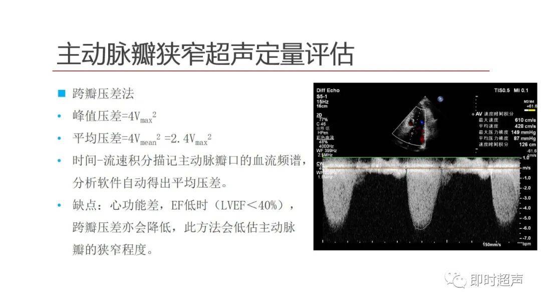 女50 胸悶氣短,活動後加重,有關節炎史二尖瓣狹窄伴關閉不全,全心增大