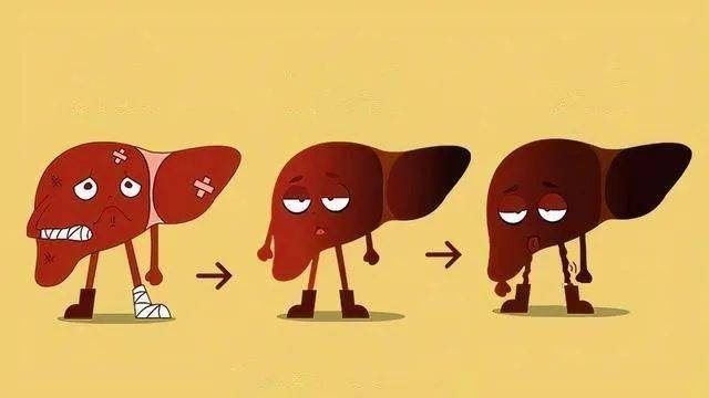 如何早期发现肝硬化认识一下肝掌和蜘蛛痣