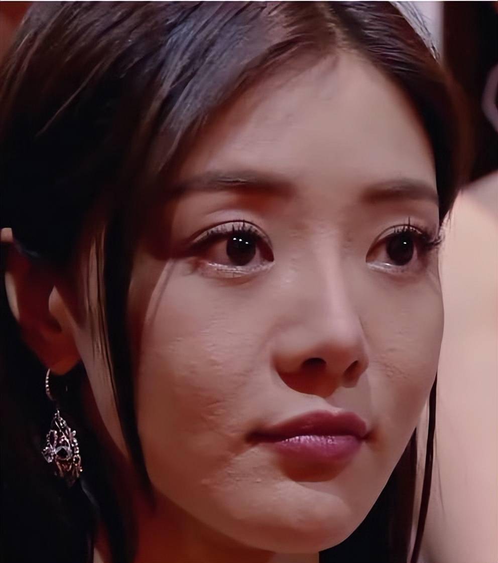 惊讶明星中的痘痘脸皮肤不如普通人钞能力都救不回来