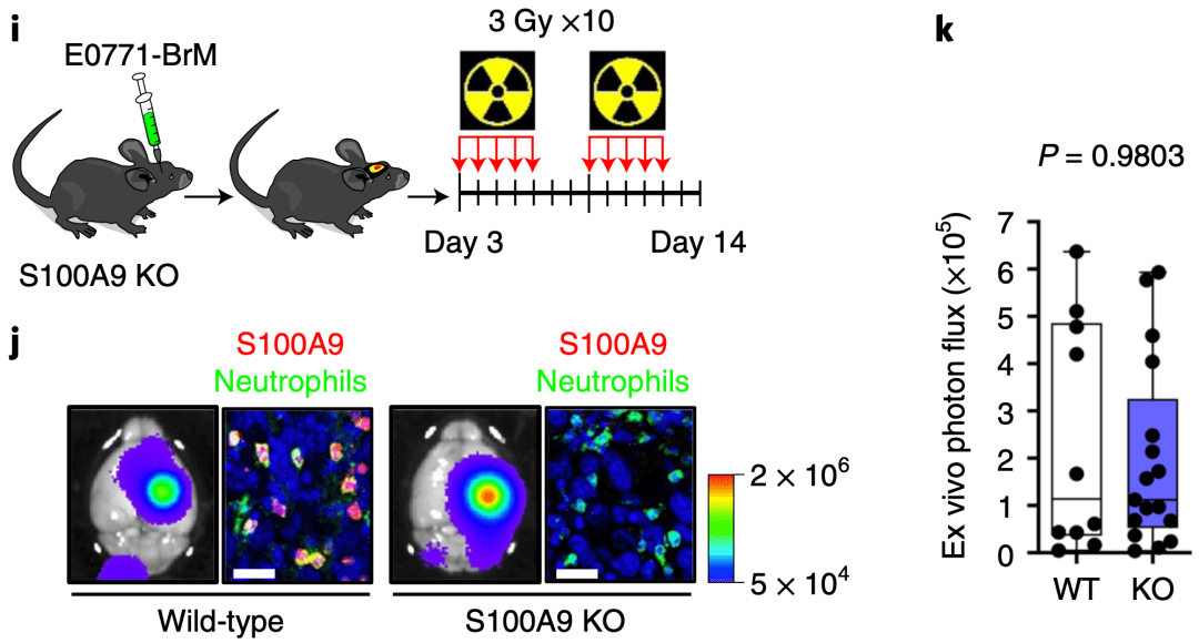 s100a9基因敲除小鼠脑转移模型对放疗抵抗鉴于s100a9与脑转移癌放射敏感性的