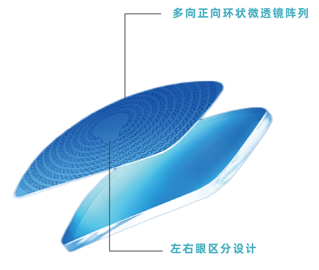 全新一代近视管理镜片——视无界双面复合多点微透镜片_孩子_视觉_戴