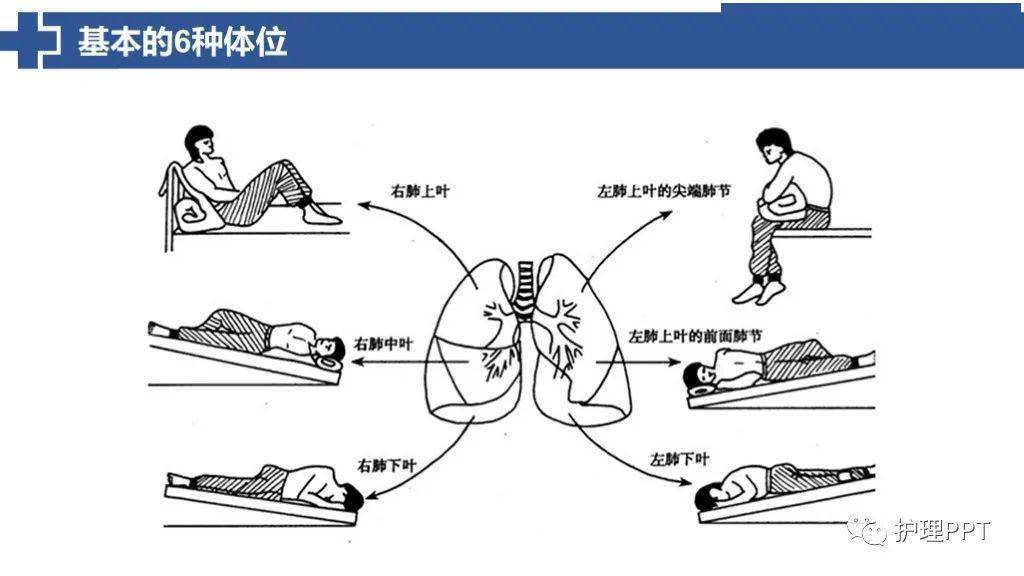 ppt清理呼吸道分泌物的護理技術