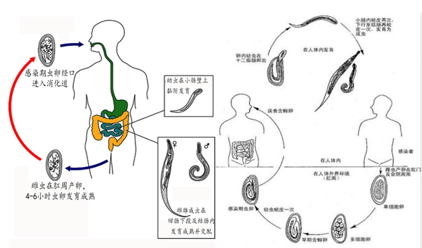 肛门蛲虫病的症状图片