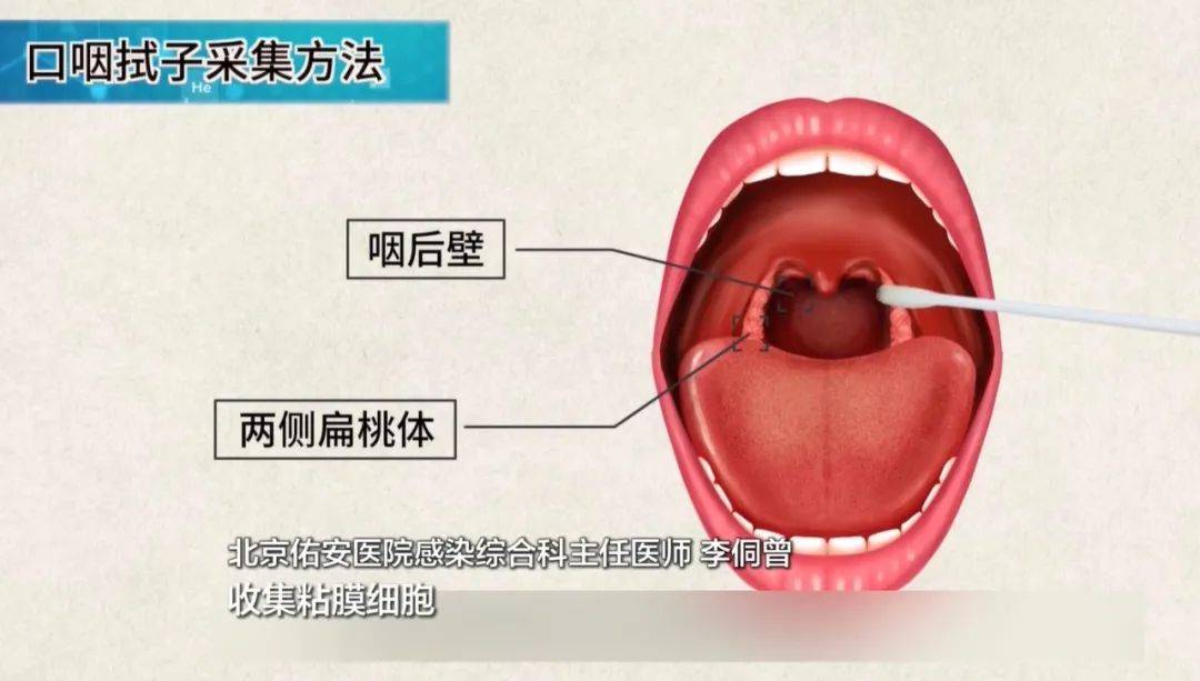 舌根在哪个位置图片