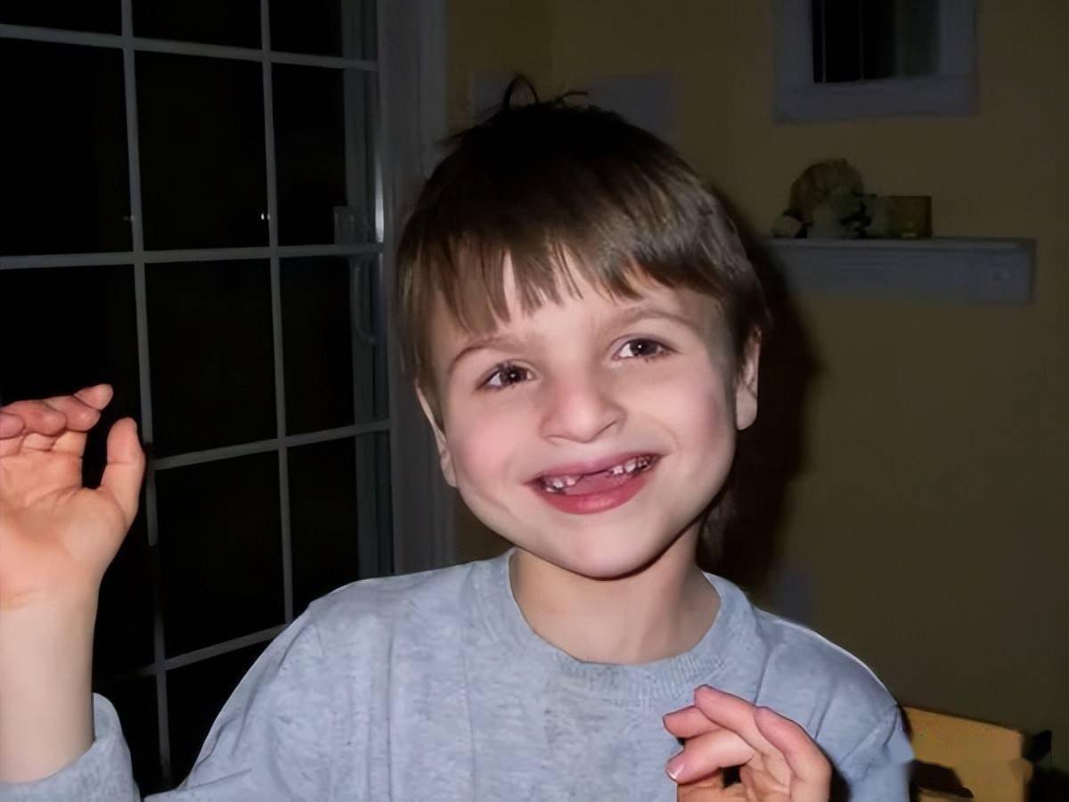 天使般笑脸的背后_综合征_孩子_诊断