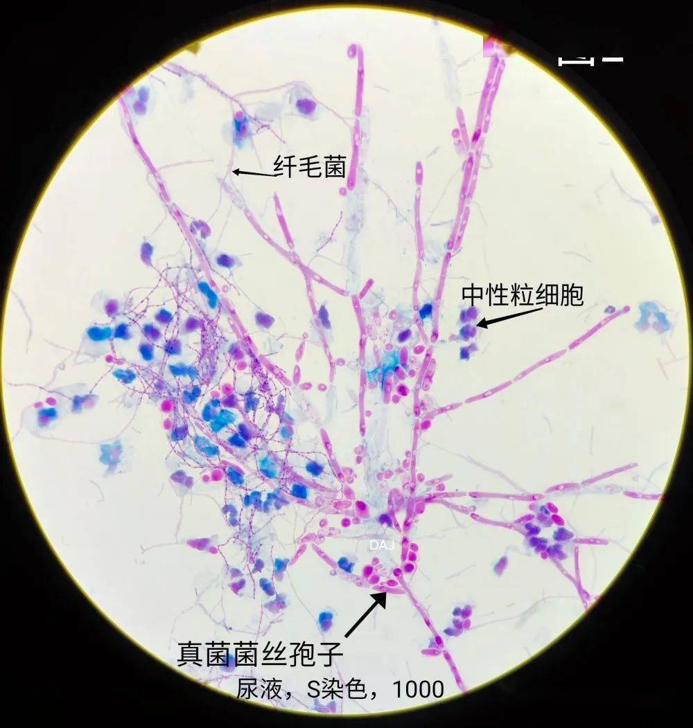 纤毛菌图片图片