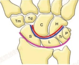 腕關節常見骨折及脫位影像改變_腕骨_三角_韌帶