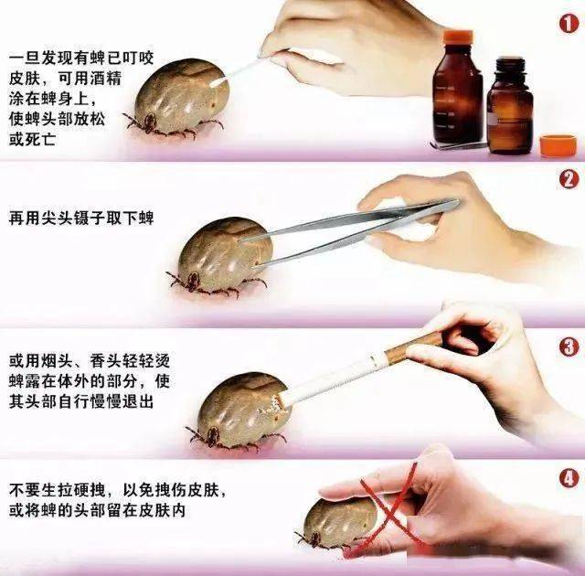 口器残留无法进一步取出;3.伤口感染;4.蜱虫可能附着已经超过 24 小