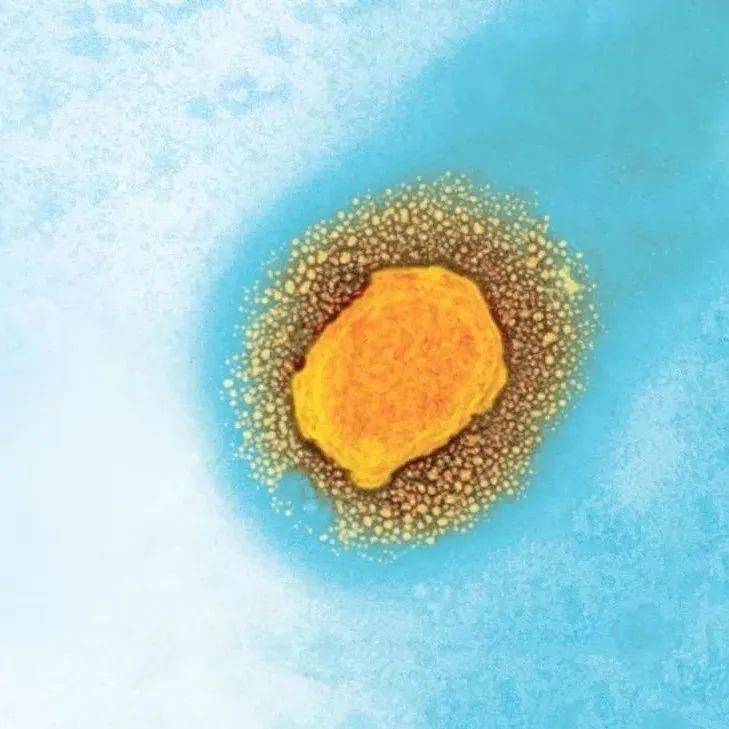 人际传播被证实，猴痘会成为下一个“天花”吗？_郭威_接种_疫苗