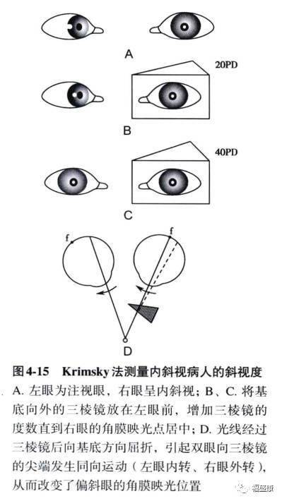 kappa角测量方法图片