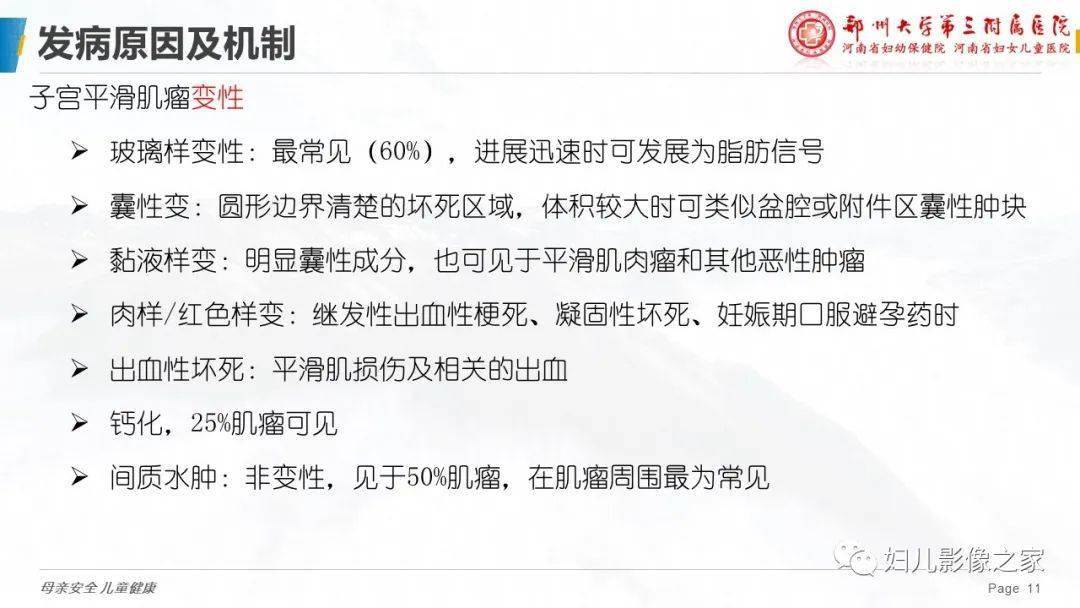 子宫平滑肌瘤变性的影像诊断