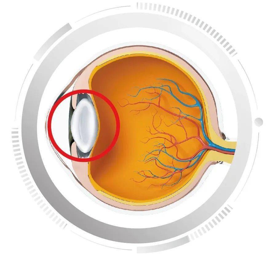 白内障的六大谣言_手术_晶状体_身体