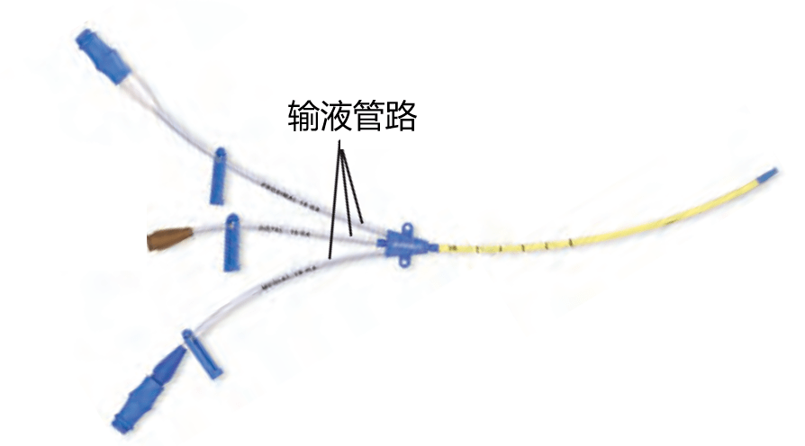 鎖骨下靜脈穿刺置管術操作流程高成功率