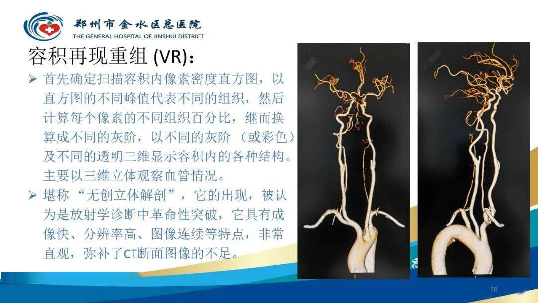 头颈cta扫描技术与临床应用