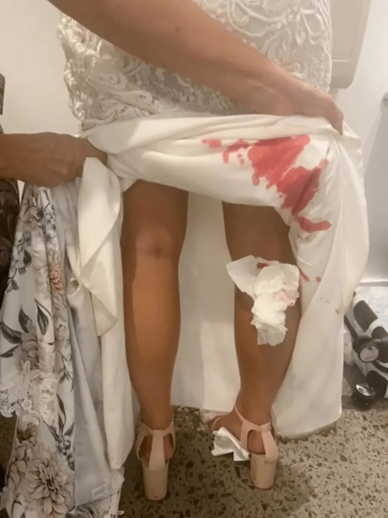 昆州新娘婚礼上正和老公跳舞裙下突然涌出鲜血这个东西害人不浅