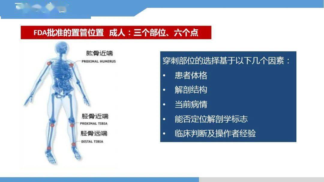 【ppt】永不塌陷的生命通路-骨髓腔輸液技術_護理_微信_中衛