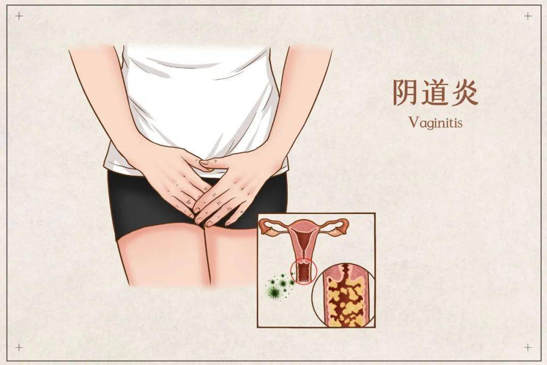女性B型大全下面 尿道图片